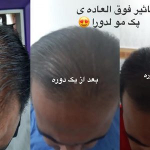 مشاور ونماینده ی فروش  محصولات گیاهی لدورا