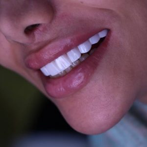 دندانپزشکی درتیس