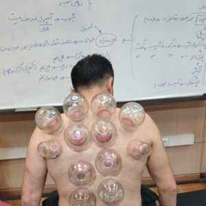 آموزش حجامت