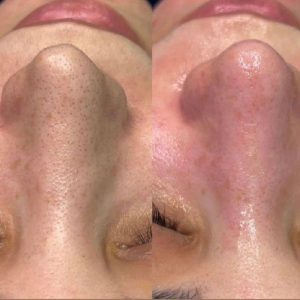 فیشال و پاکسازی