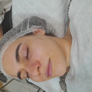 مدل برای زیبایی پوست