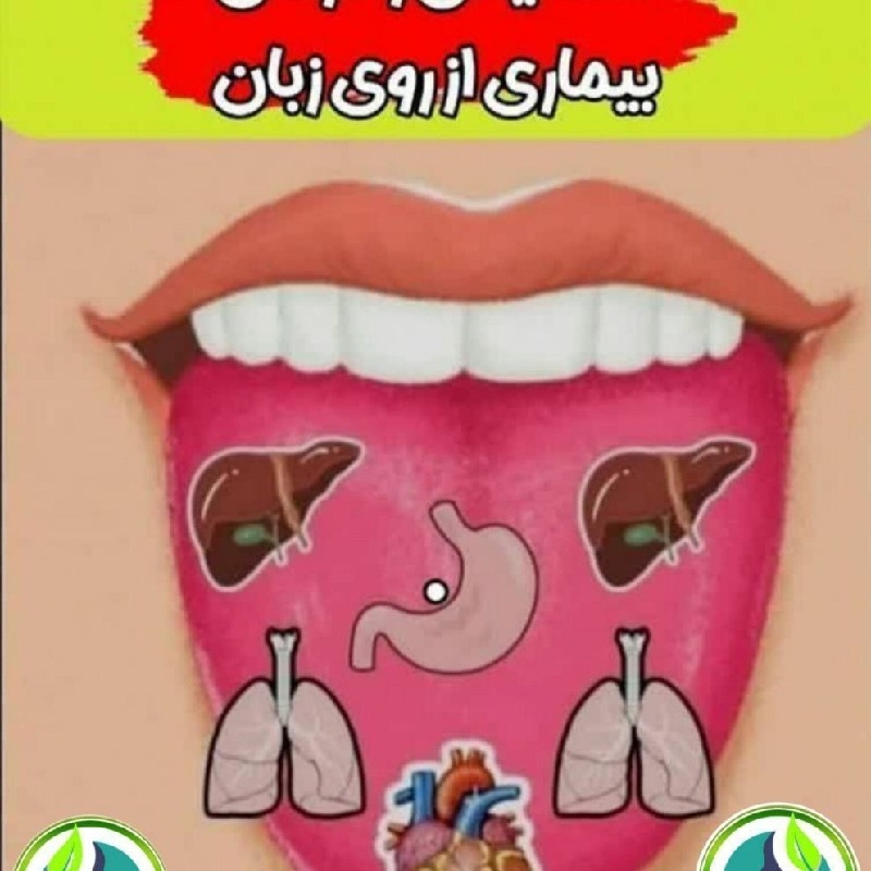 سونو گرافی با عکس زبان بیماری های که دچار آن هستید گفته می‌شود و راه درمان را برایتان میگوییم