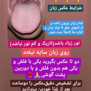 مشاوره