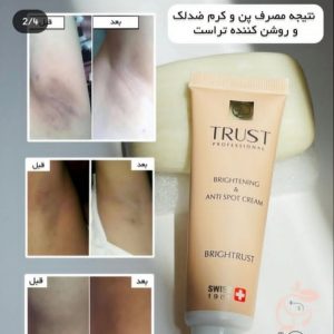 مشاوره پوست مو