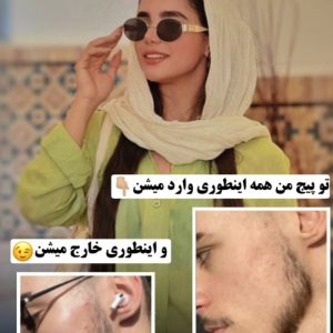 رویش و پرپشتی ریش و سیبیل