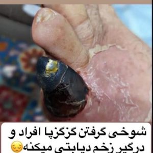 درمان دیابت