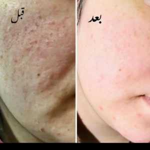 آموزش فرمول کرم های سفید کننده