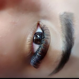 کاشت مژه