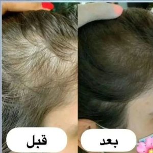 رشد سه برابرمو