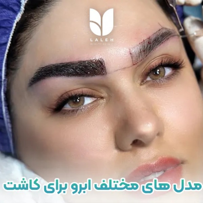 مدل کاشت ابرو با هزینه ویژه | ۴۰ میلیون ← فقط ۸ میلیون