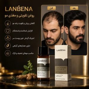 روغن رشد مو